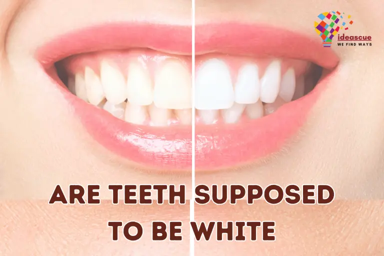 Are Teeth Supposed to Be White? Dental Insight